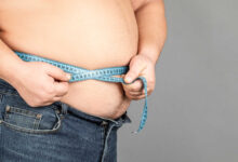 Dr Marco Túlio Cruvinel - Sabia que a obesidade pode aumentar o risco de ter cálculos renais