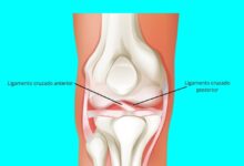 Ortopedia Goiânia - Qual a função dos ligamentos cruzados anterior e posterior do joelho