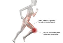 Ortopedia Goiânia - Saiba as causas da Síndrome do Trato Iliotibial